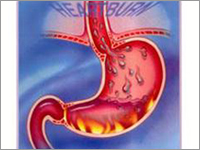 Pharmaceuticals for Heartburn