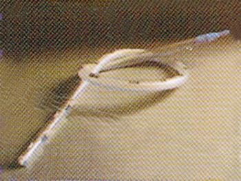 Catheter