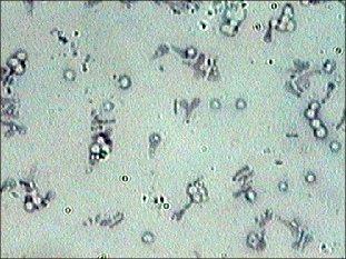 FOOD PRODUCTS : CULTURE (RHIZABIUM)