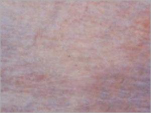 Marble