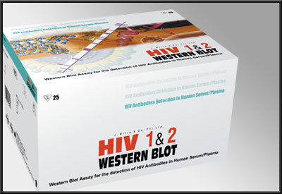 HIV Western Blot