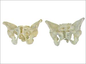 Adult Male Pelvis (XC-123) & Adult Female Pelvis (XC-124)