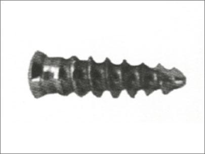 Anterior Cervical Plate System
