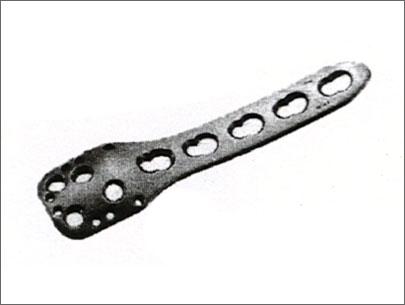 Medial Proximal Tibia Plate