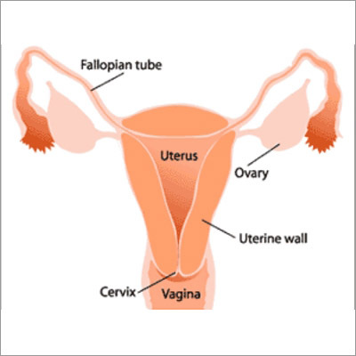 Infertility