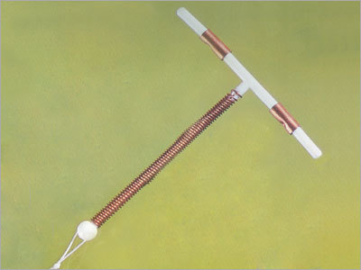 The Unmatched Nugard 380A