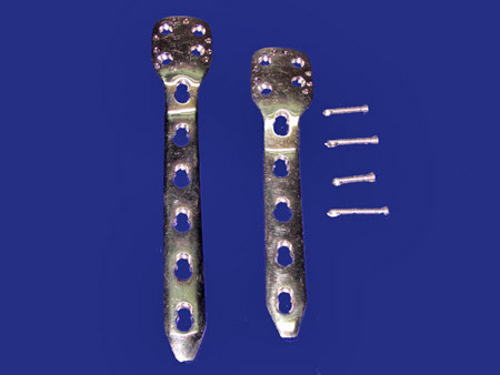 LCP Humrus Plate