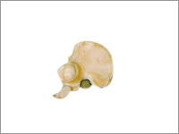 Pelvic Bone