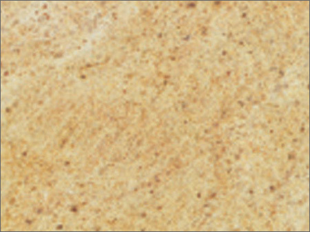 Madurai Gold Granite
