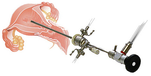 Gynecology Surgery Equipments Set
