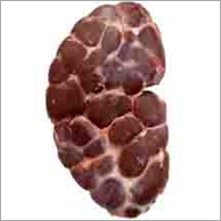 Kidney
