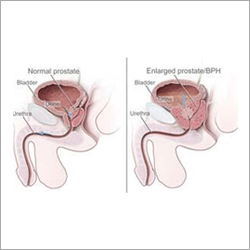Genito Urinary System Pharma Pellets
