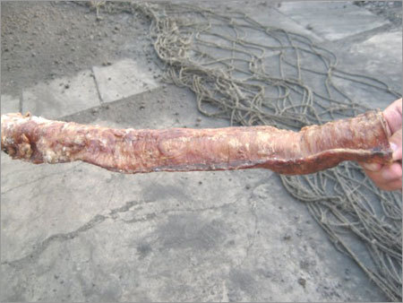 Trachea