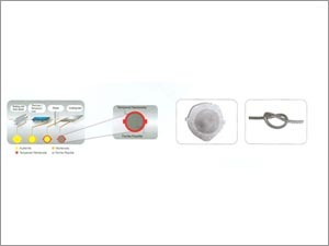 Sponge Iron & Steel Castings
