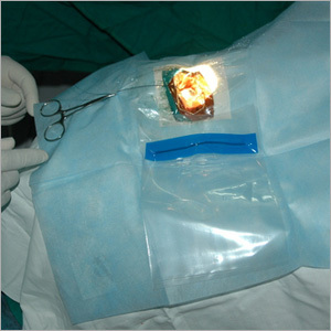 Surgical Disposables