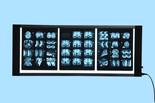 Three Film X Ray Viewer