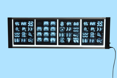 Medical X-ray illuminator (X-ray view box)
