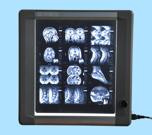 Economical LED Based Single Film Viewer