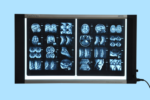 Medical X-ray illuminator (X-ray view box)