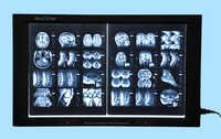 Digital 2 Film X-ray Illuminator With Film Sensor