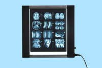X-ray Illuminator (x-ray View Box)