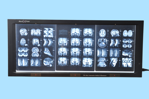 Digital Four Film Illuminator with Film Activation