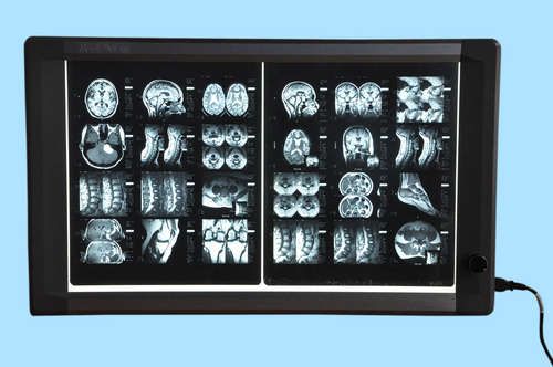 Programmable Digital X-ray Illuminator