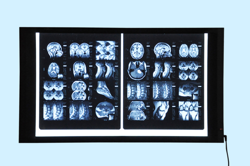 Medical X-ray illuminator with external power