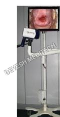 Digital Video Colposcope - Advanced Imaging Technology, Enhanced Visualization Features, User-friendly Interface