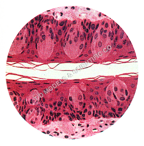 GYMOSPERM