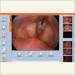 Digital Endoscopy Display