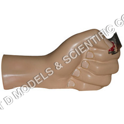 कैडेवरिक ऐंठन