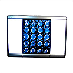 Lcd X-ray Film Viewer