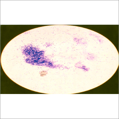 Bacillus Subtilis