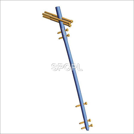 Easy Universal Femur Nail