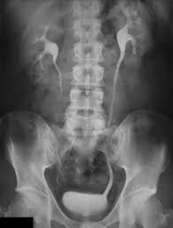 X Ray Film