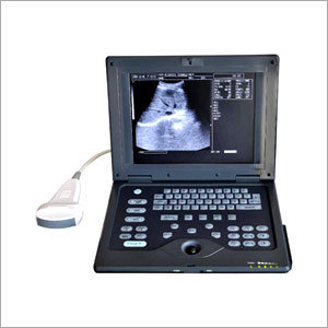 Pam Size Ultrasound Scanner