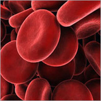 Blood Cancer Ayurvedic Therapy