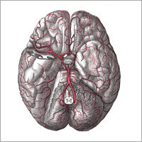 Insufficient Blood Supply To The Brain
