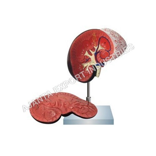  Human Kidney With Adrenal Gland-2 Parts