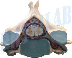 Fifth Cervical Vertebra Model