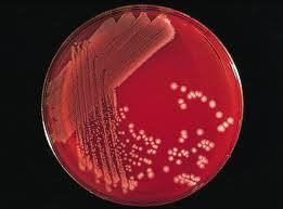 Microbial Limit Testing Services