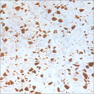 Mosaic Tiles
