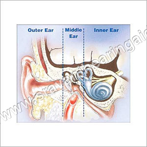 Hearing Loss And Its History