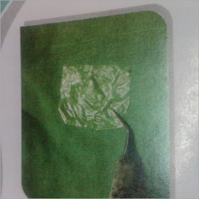 Dry Amniotic Membrane Dry Amniotic Membrane
