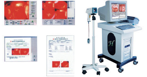 KOBRA DIGITAL COLPOSCOPE