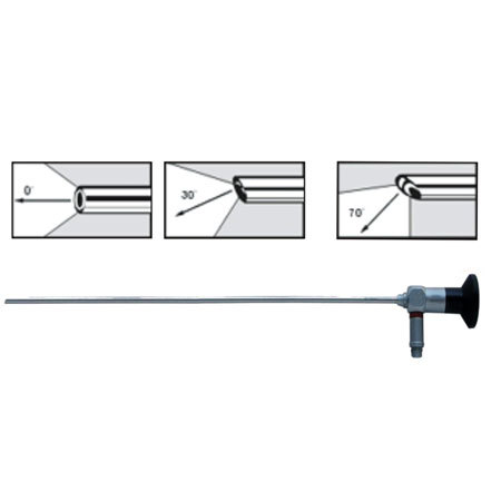 Hysteroscope