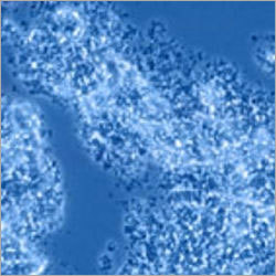 Wastewater Treatment Chemicals