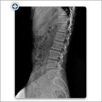 Digital Radiography - Plastic Material, For Hospital Use | Suitable For Patient Use