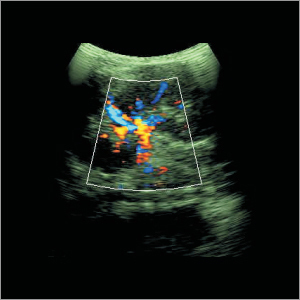 Ultrasound Machinery